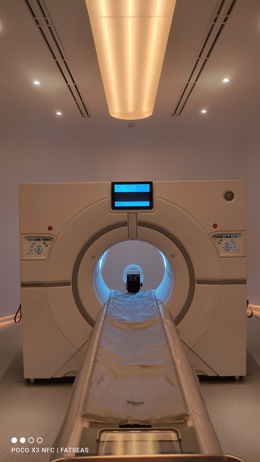 CT Scan Revolution